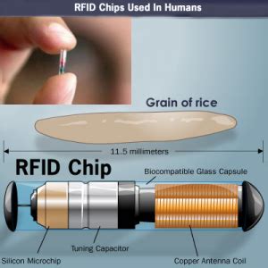 does obamacare require rfid chip|ObamaCare Implant: ObamaCare Microchip RFID Myth.